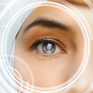 Cirurgia da Catarata 